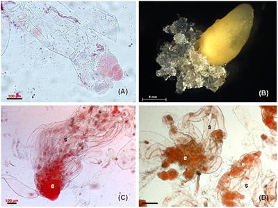 Somatic Embryogenesis in Selected Conifer Trees Pinus nigra Arn. and Abies Hybrids